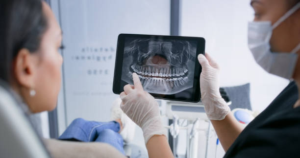 Licensed Tooth Extraction service in Santa Ana, CA - Smile Center Dentistry